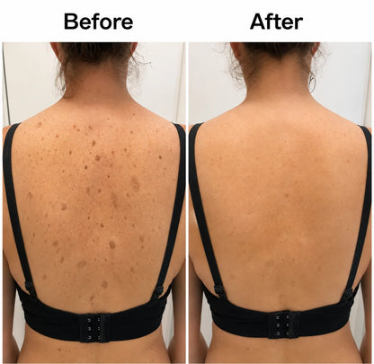 Smooth & Even Glycolic Body Stick